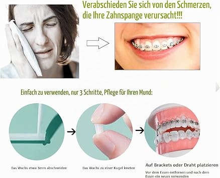 Pack of 10 Braces Wax Orthodontic Wax for Braces Braces Wax to Relieve Irritation Pain (10 Types of Flavour)