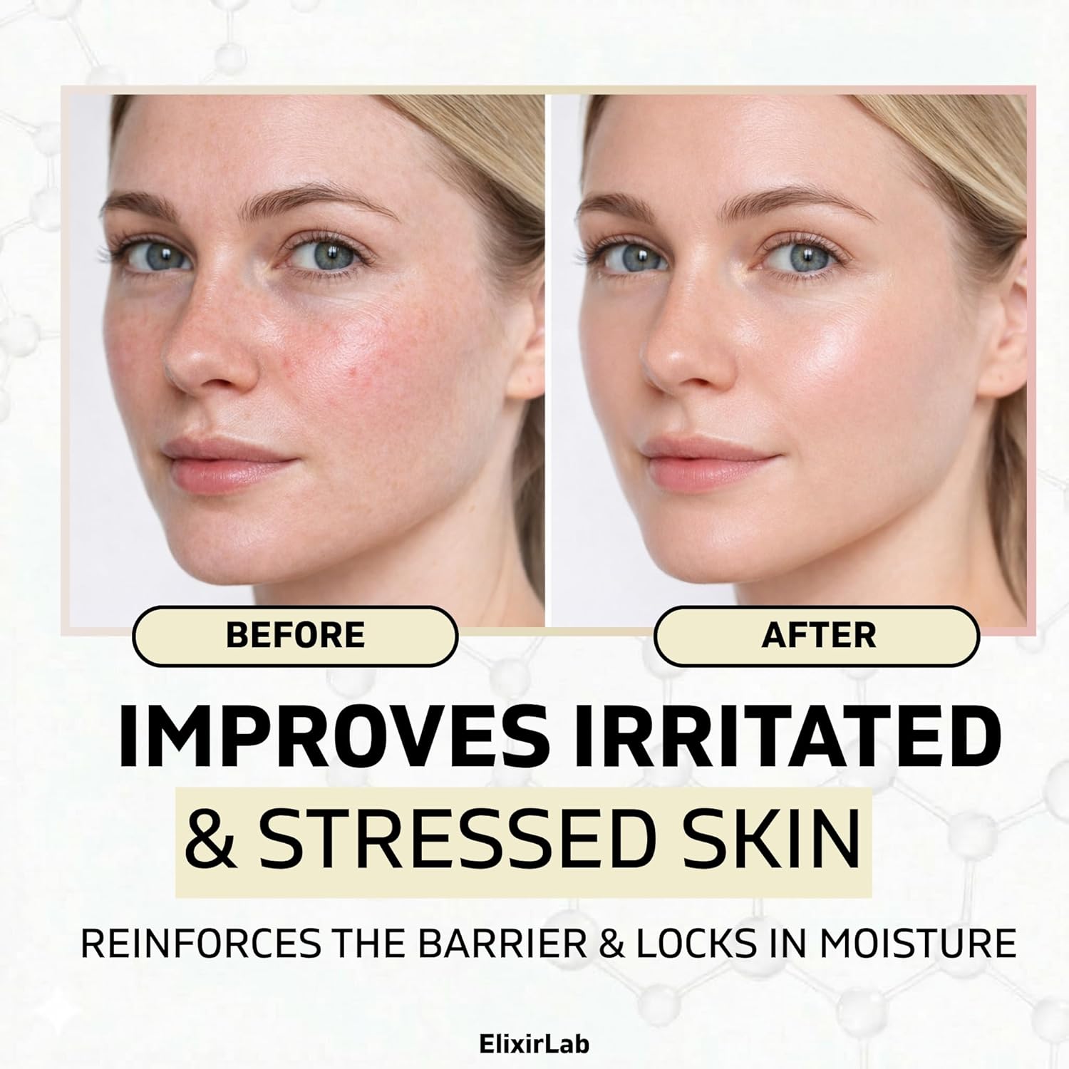 Ectoin Cream 10,000ppm | Korean Barrier Repair Moisturizer with Panthenol, Niacinamide & MELAZERO®V2 | Fragrance-Free for Sensitive, Dry & Reactive Skin | 1.69 fl oz
