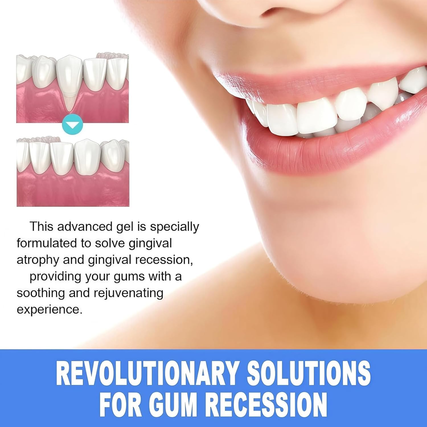 2Pcs Gum Protect Repair Dental Gel, Natural Gum Care Gel for Gums Repair & Oral Comfort, Teeth Whitening Essence Pen, Gentle Dental Gels for Daily Gum Health