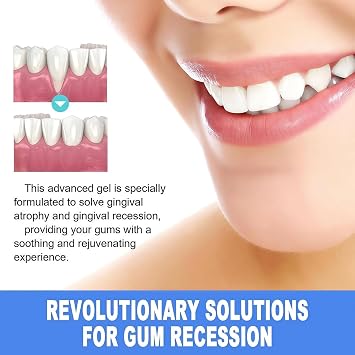 2Pcs Gum Protect Repair Dental Gel, Natural Gum Care Gel for Gums Repair & Oral Comfort, Teeth Whitening Essence Pen, Gentle Dental Gels for Daily Gum Health