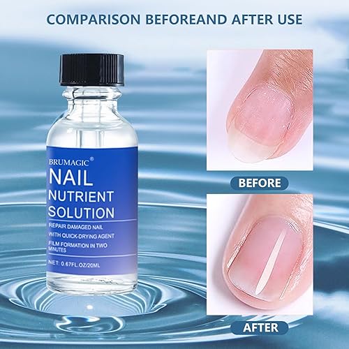 Miniatura 3 de Restauración de hongos en uñas extra fuertes para uñas de manos o pies, solución de reparación de uñas, solución nutritiva para uñas dañadas y