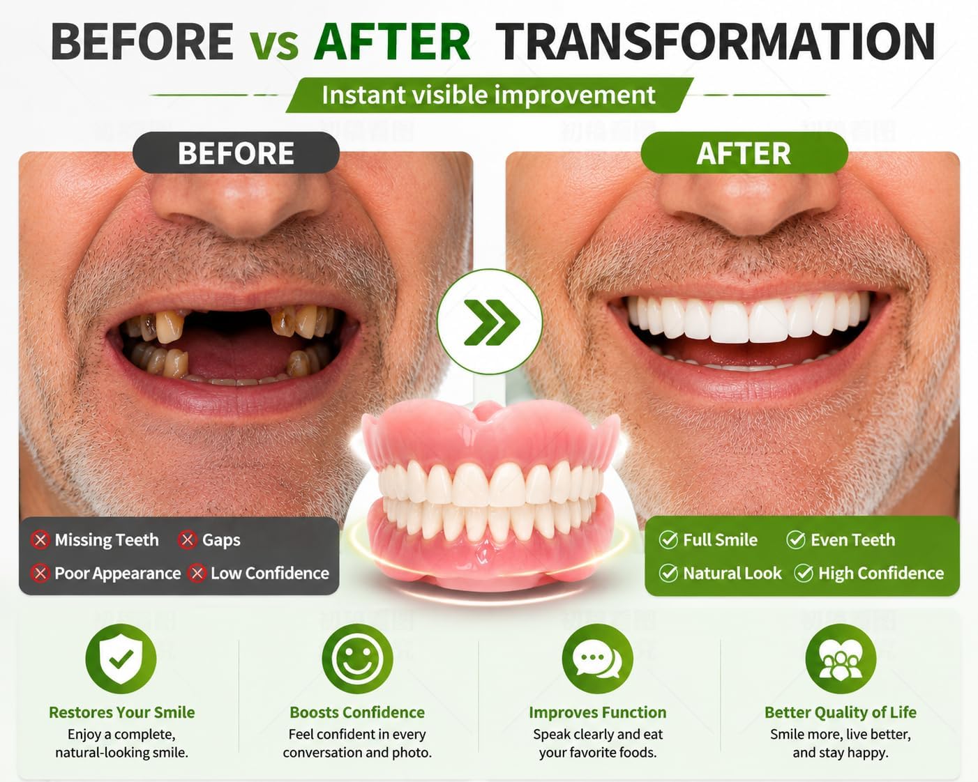 dentures kit DIY,making partial dentures and full Denture Kit ， Simple and convenient-RP01 (all-natural)