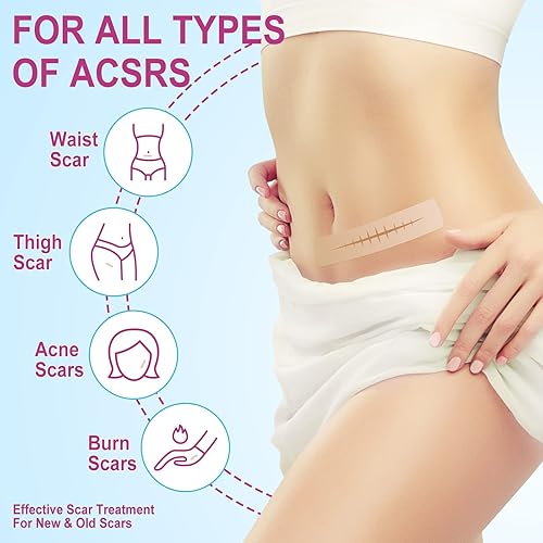 Miniatura 7 de Hojas de silicona para cicatrices rollo de cinta de silicona suave para eliminar cicatrices parche de tratamiento profesional impermeable