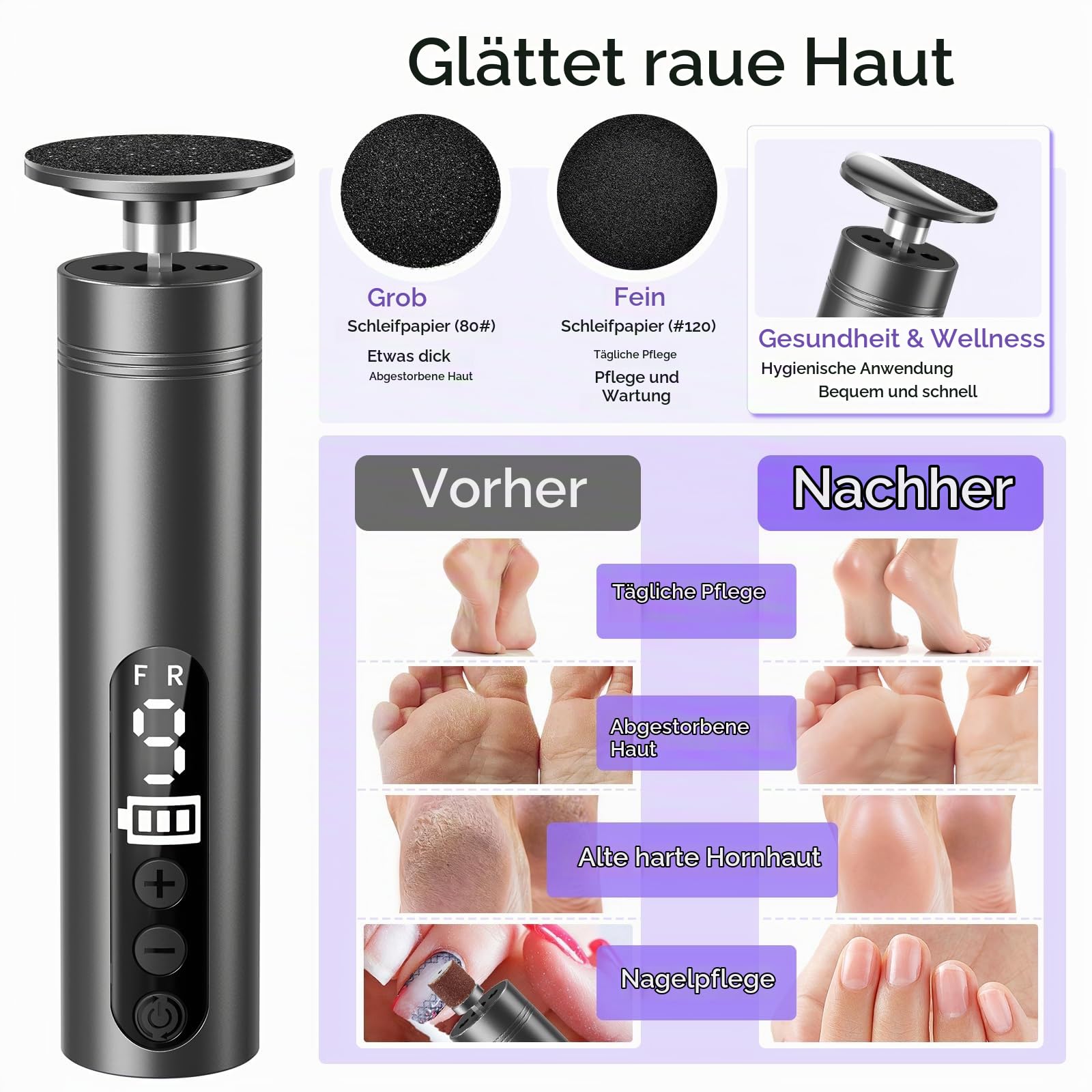 Hornhautentferner Elektrisch 2-IN-1, 9 Geschwindigkeiten Elektrischer Hornhautentferner, Wiederaufladbar mit Type-C, Pediküre Fußpflege Set Elektrisch für Tote Harte Rissige Haut