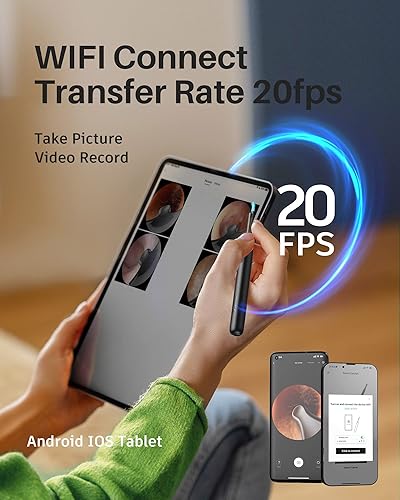 Miniatura 8 de Cámara de herramientas de eliminación de cera de oído, limpiador de oídos, cuchara de oído segura no desmontable, kit de eliminación de cera de