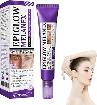 Ceoertys EPIGLOW MelanEX Advanced Anti-Hyperpigmentation Cream, Dark Spot Cream For Hyperpigmentation Treatment, Anti Aging Face Cream, Dark Spot Remover 20g 1
