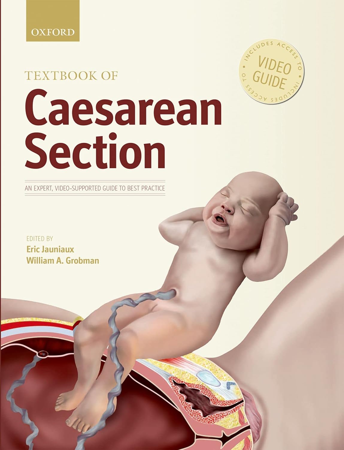 Textbook of Caesarean Section      Kindle Edition