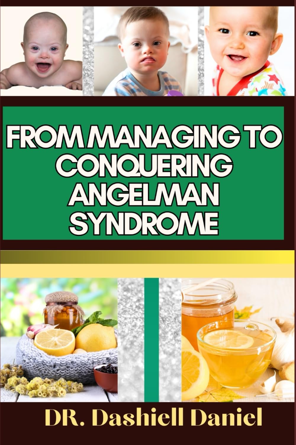 FROM MANAGING TO CONQUERING ANGELMAN SYNDROME: Expert Guide To Overcoming Challenges and Triumphing Over Angelman Syndrome, One Step at a Time