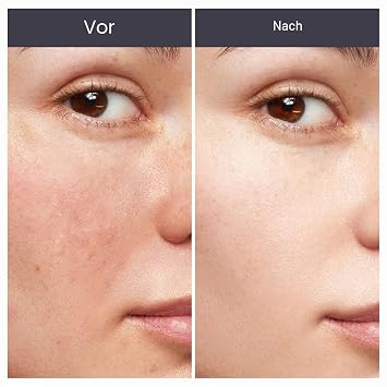 Peel Shot mit Schwarzem Reis & Aktivkohle – sanftes Serum Peel Shot für reine Haut Peeling Shot für matte & glatte Textur Poren reinigend 100ml