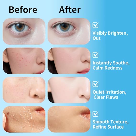 60 Pcs Tea Tree Oil Cleaning & Exfoliating Wipes, Pore Minimizer, Radiance | With AHA, BHA, Lactic Acid, Glycolic Acid, Makeup Remover Wipes, Toner Cotton Rounds, Facial Radiance Pads for Women,