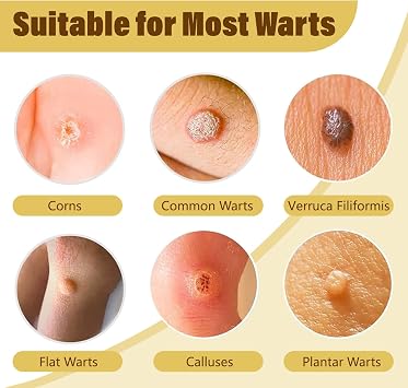 Fast-Acting Skin Tag Remover, Bee Venom Wart Remover with 12% Salicylic Acid for Body and Neck, Maximum Strength Liquid Skin Tag Removal Kit for Plantar Wart, Common & Flat Wart, Corn, Callus-B1