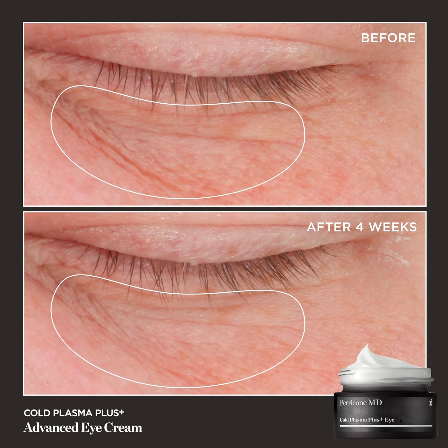 Perricone MD Cold Plasma Plus+ Advanced Eye Cream, 0.5 fl. oz. - Image 5