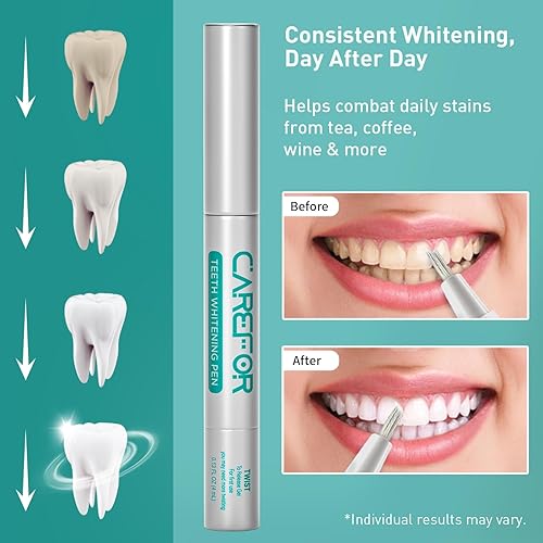 Miniatura 3 de Bolígrafo blanqueador de dientes, 1 paquete (0.1 fl oz) de gel blanqueador de acción rápida con aplicador de cepillo, kit de viaje portátil para