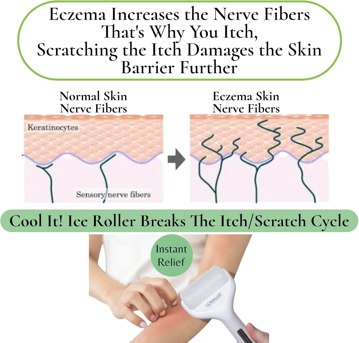Loma Lux Cool IT! Ice Roller for Face & Body Puffiness, Itch & Sunburn