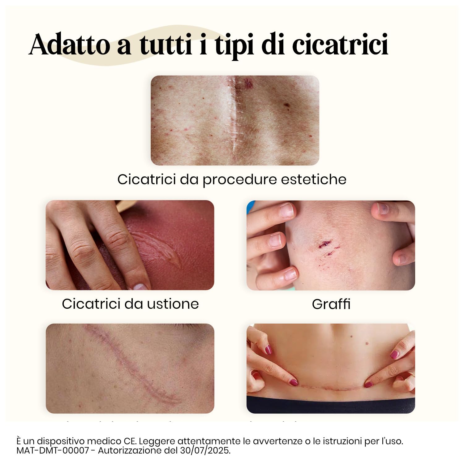 Dermatix Gel al Silicone per Cicatrici 15g Trattamento Cicatrici Ustioni
