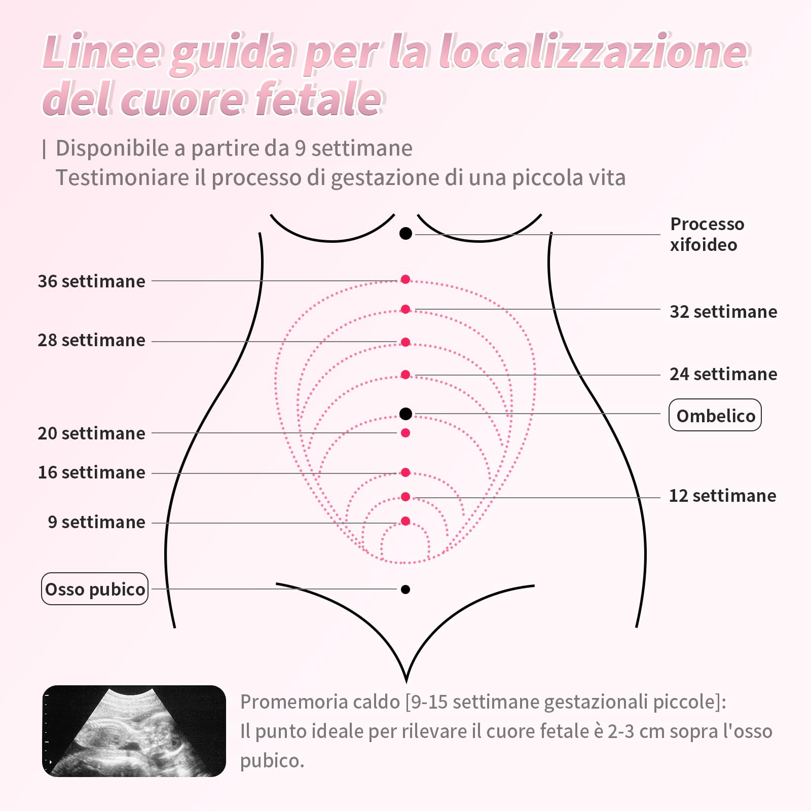 Regalo di Gravidanza Illustrazione Mano | Souvenir Unico di Gravidanza(Modello #U8) (Bianco tinta unita)