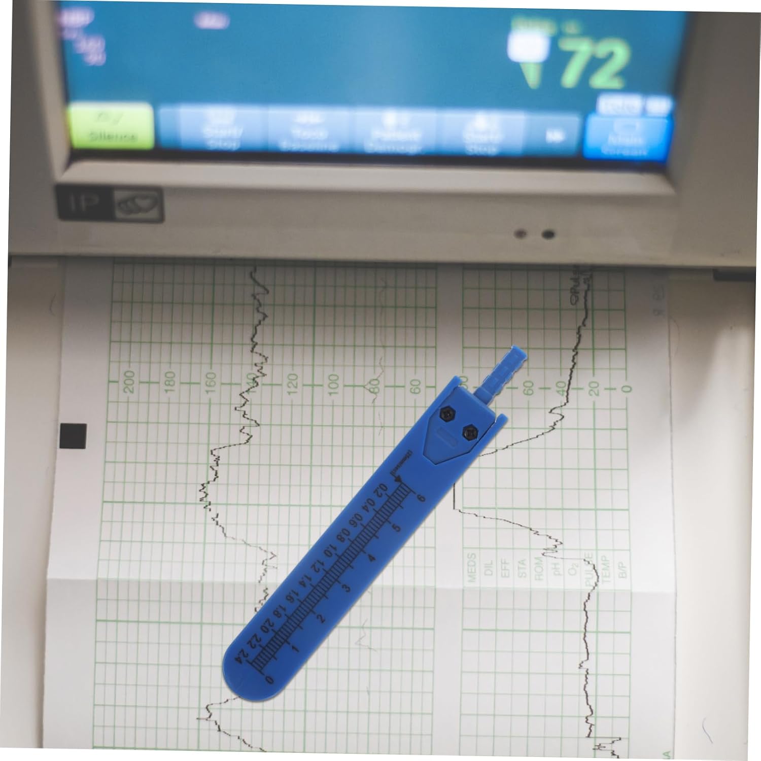 1pc Electrocardiogram Divider Measuring Tool for Doctors and Nurses Calipers Storage Case for Accurate Wave Measurement Blue