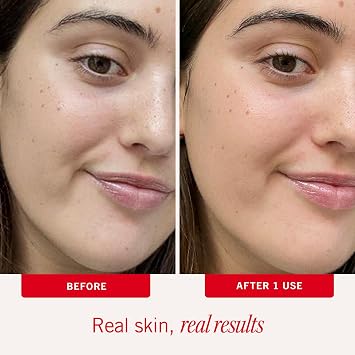 First Aid Beauty - Ultra Repair Face Moisturizer, Soothing Face Colloidal Oatmeal, Everyday Lightweight Non-Comedogenic Formula Helps Soften Skin with Ceramides and Shea Butter, 1.7 oz