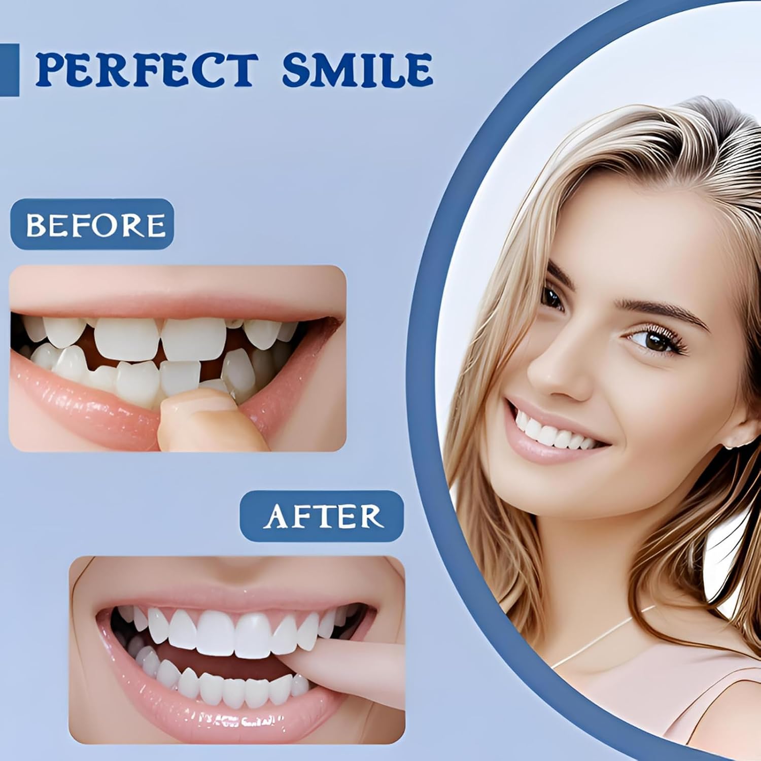 Temporary Veneers Kit for Women and Men, Tooth Replacement Kit, Adjustable Veneers Kit, Nature and Comfortable