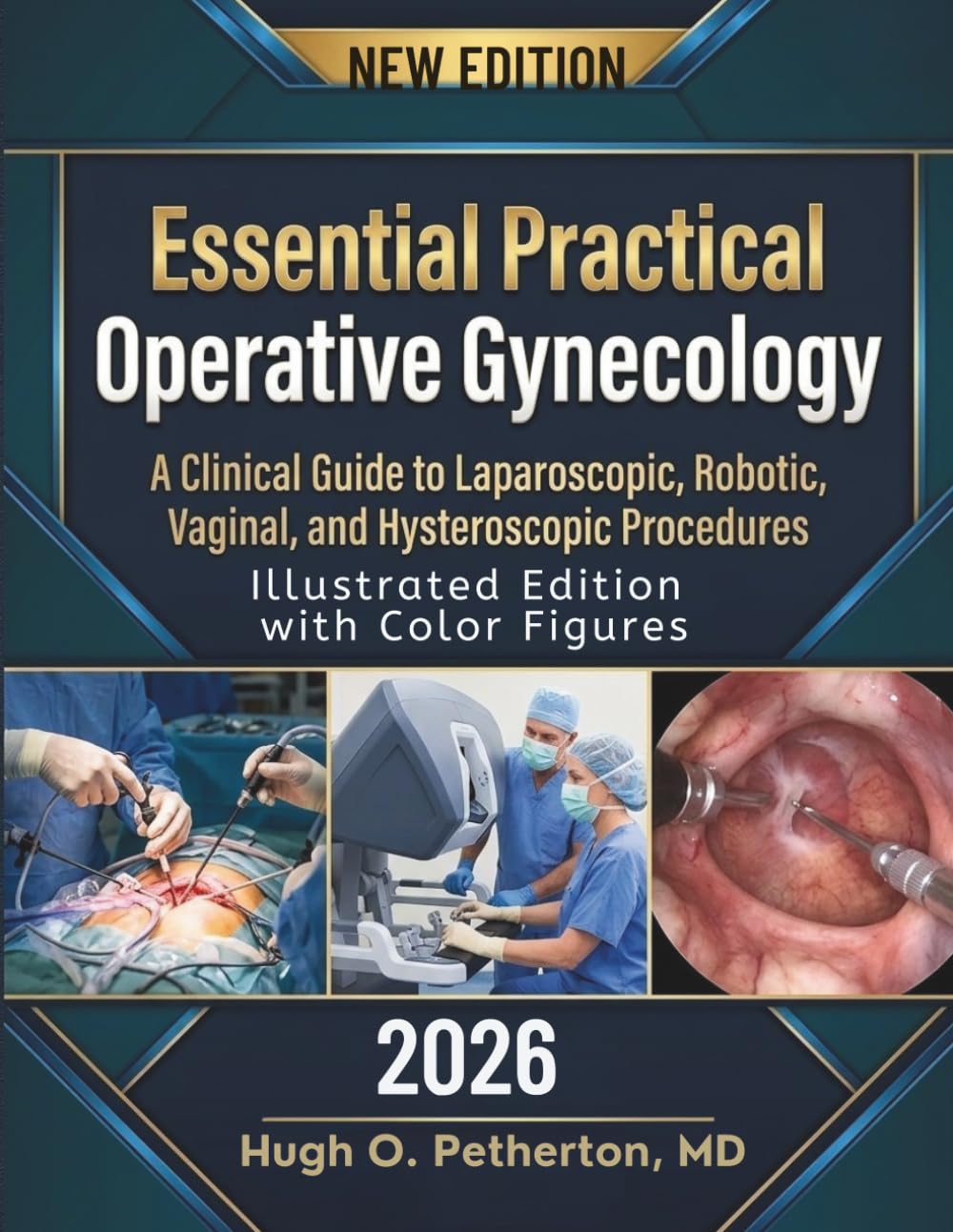 Essential Practical Operative Gynecology: A Clinical Guide to Laparoscopic, Robotic, Vaginal, and Hysteroscopic Procedures