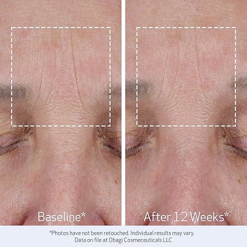 Miniatura 6 de Obagi ELASTIderm Lift Up & Sculpt - Crema facial antienvejecimiento clínicamente probada que reafirma y esculpe visiblemente los contornos faciales,