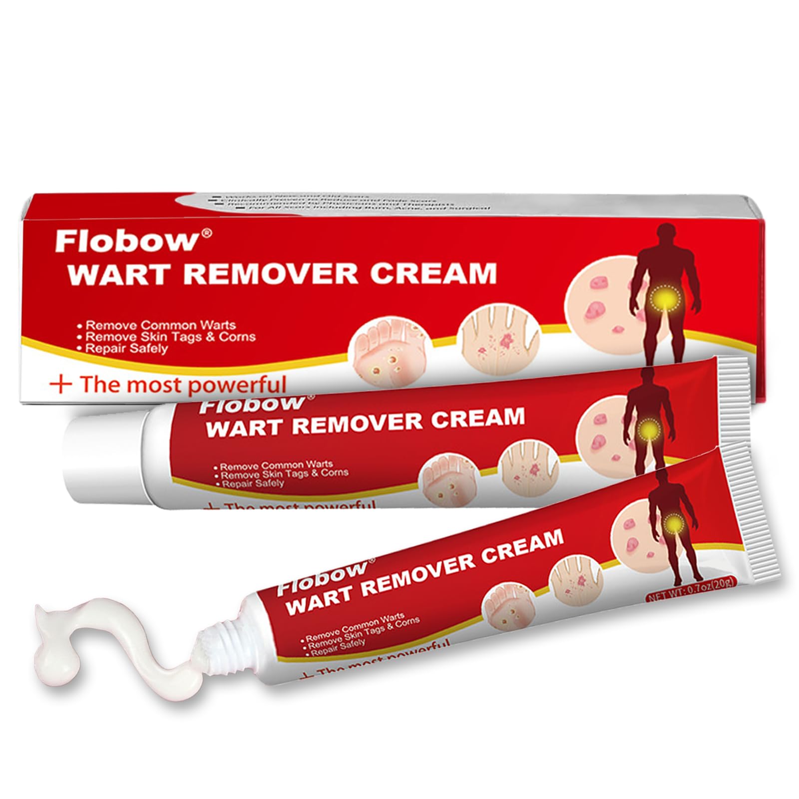 RCSCBC Wart Off Wart Remover Ointment,Fast-Acting Wart Remover Gel with Freeze Off Technology-Wart Cream for Condyloma Acuminatum, Plantar, Common, Flat, Genital