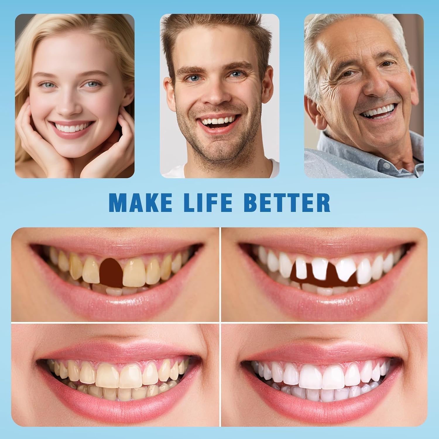 Moldable False Teeth - Silicone Dentures - Men and Veneers Teeth for Women - Upper and Lower Matching Set - Fix Your Smile at Within Minutes - Blue - 1PCS - Y7hreghr