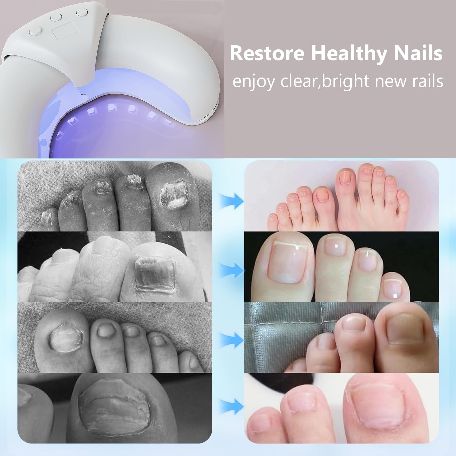Dispositivo de Láser de Hongos Uñas Regulable, dispositivo para limpiar y cuidar las uñas, para varias uñas de manos y dedos de los pies, para uñas dañadas y decoloradas, con pantalla digital y funció