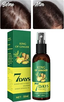 Shouga Kingu Hair Growth Oil, King of Ginger 7 Days Hair Growth, Shougagro Japanese Hair Growth Spray, Ginger Oil for Hair Growth, Anti-Hair Loss Oil 1Pcs
