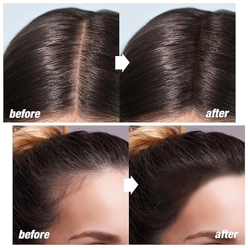 Miniatura 2 de Boobeen Barra de sombra de línea de cabello, corrector de raíces de cabello y polvo de retoque con esponja, cobertura instantánea para cabello gris