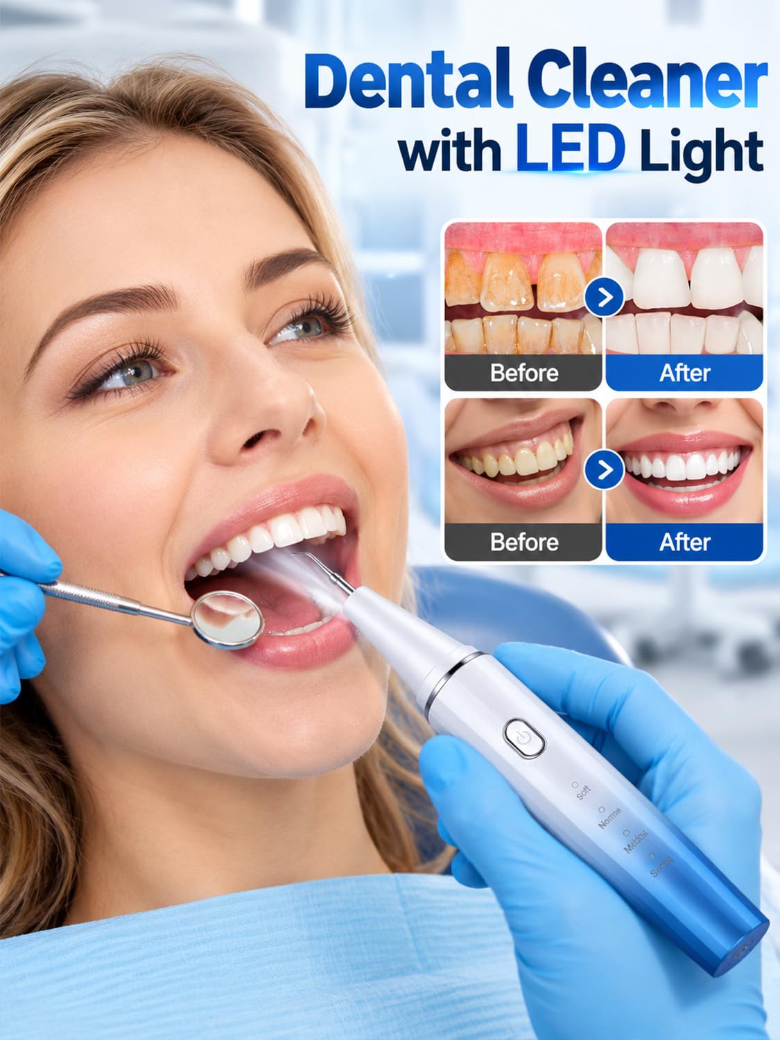 Sonic Dental Cleaner - Travel & Home Use -6 Sonic Dental Cleaner - Travel & Home Use -6