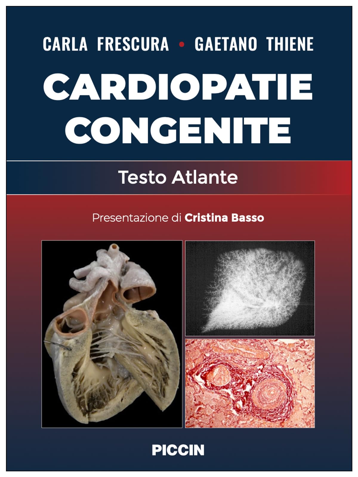 Cardiopatie congenite. Testo atlante