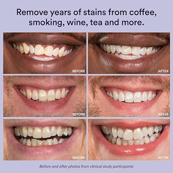 Teeth Whitening Strips - Purple Tooth whitening for Sensitive Teeth - Tooth Stain Removes Stubborn Stains - TeethWhiten Combining Whiter Teeth Colour Correction Mild 14 Strips 7 Treatments