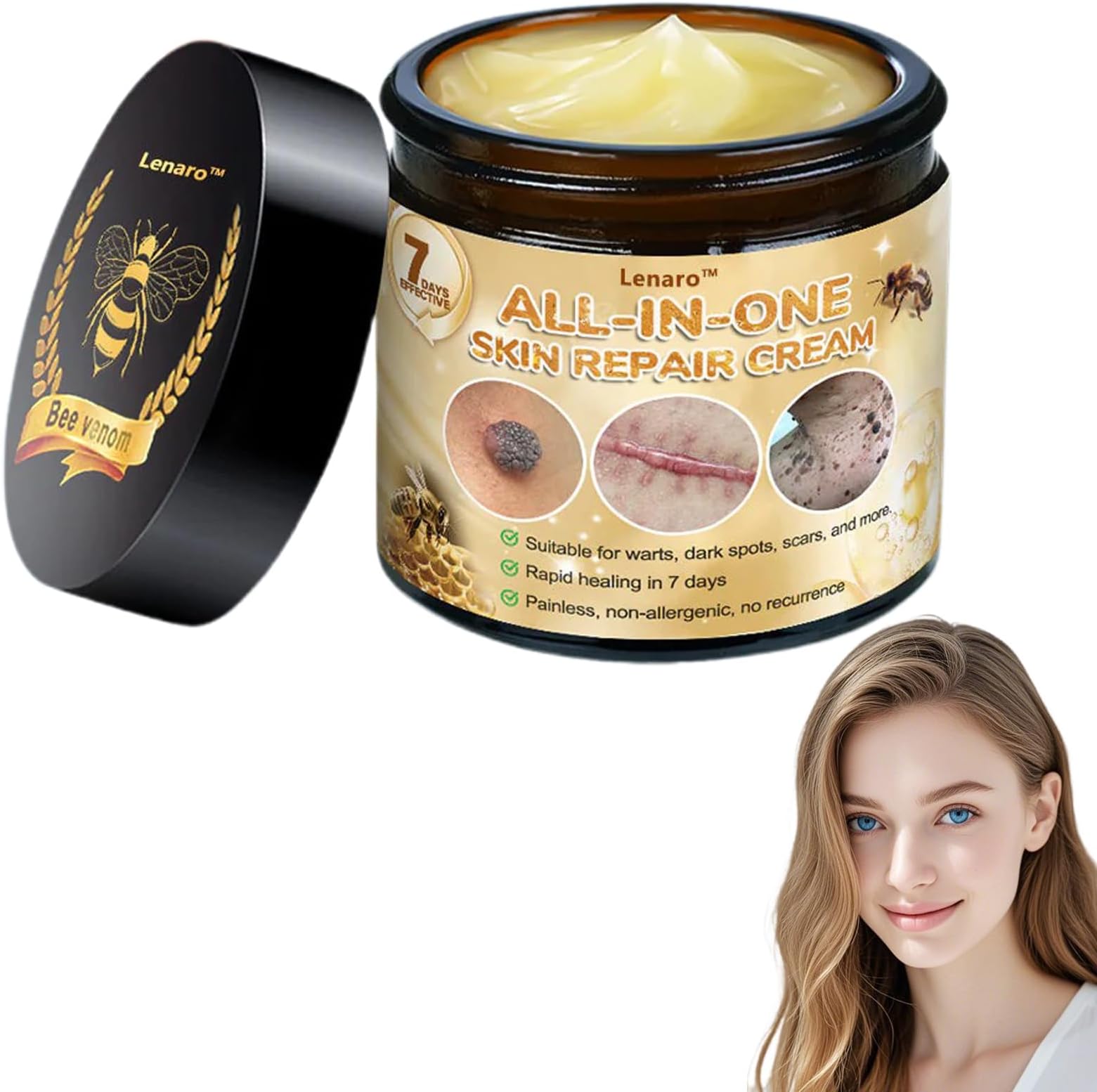 Bee Venom All-in-One Cream,Bee Venom Skin Treatment Cream,Hydrates skin and reduces blemishes (1PC)