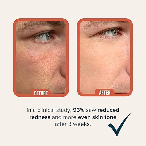 Miniatura 5 de Cardon Hidratante facial antienvejecimiento, gel coreano Hydro Boost para el cuidado de la piel, crema facial ultraligera para igualar el tono de la