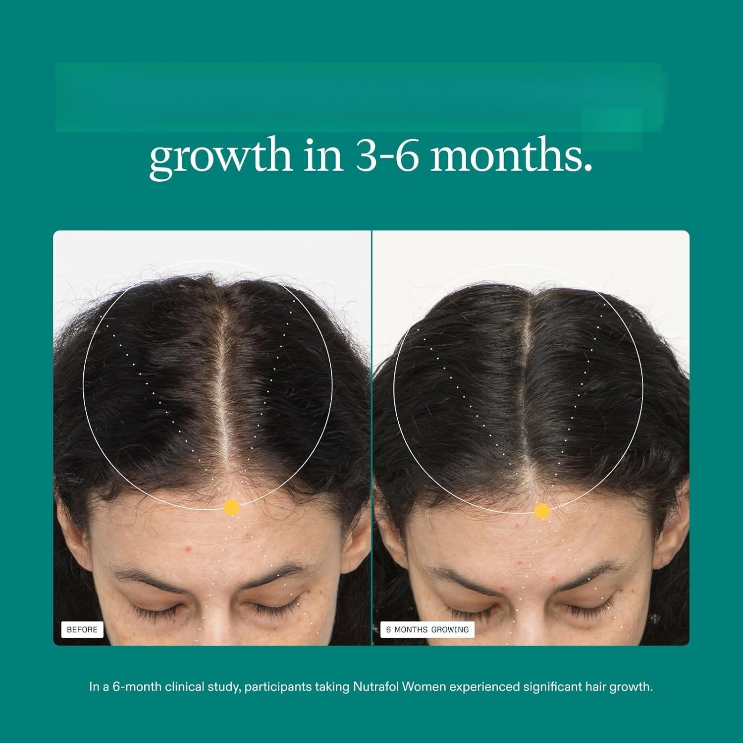 Agente de crecimiento del cabello para ayudar a espesar el cabello,