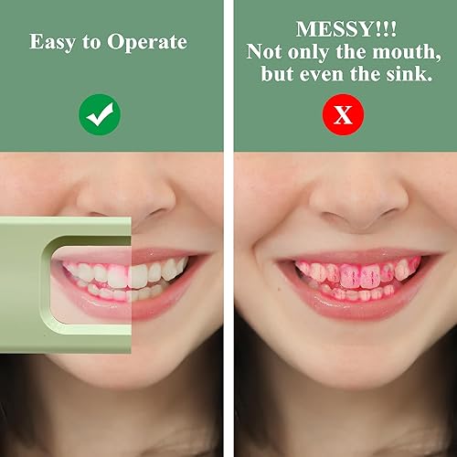 Miniatura 4 de Indicador de revelación de placa, monitor de placa dental portátil para niños y adultos, hábitos correctos de cepillado, presta atención a la