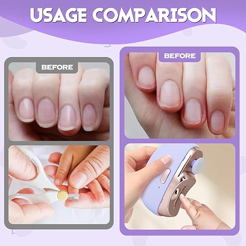 Miniatura 4 de Cortaúñas automático eléctrico 3 en 1, cortador de uñas portátil con luz, 2 velocidades, archivador de uñas, almacenamiento de clip de uñas,