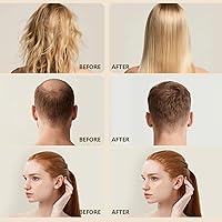 Vista 5 de Ktintar Aceite de batana crudo 100% natural para el crecimiento del cabello, sin refinar y orgánico Dr Sebi aceite para el crecimiento del cabello