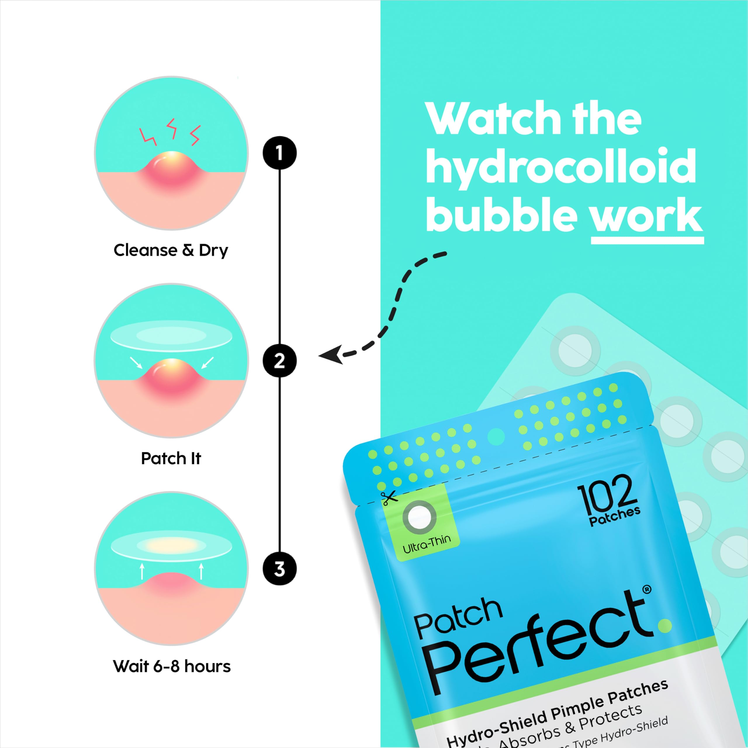 Patch Boutons (102 Unités) Pimple Patch en Hydrocolloïde Coréen, Absorbe les Impuretés, Utilisation de Jour et de Nuit, Invisibles Anti-Acné Bouton, Végétalien (2 Tailles)