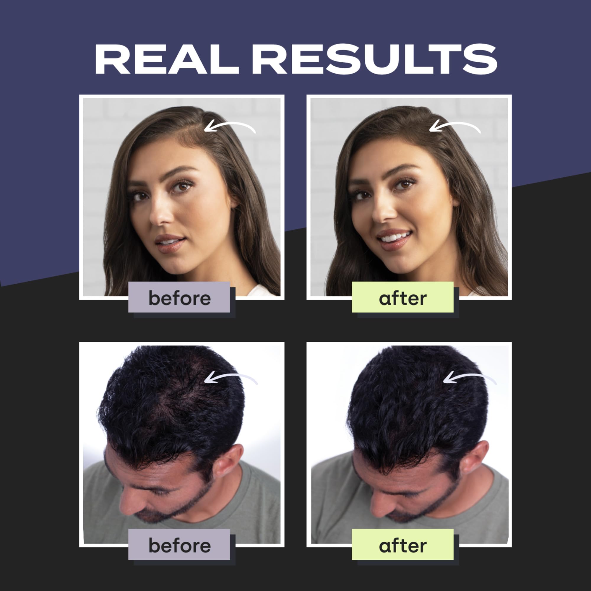 Toppik Haarfasern zur Haarverdichtung, Ansatzpuder und Streuhaar für Haarausfall und sofort volleres Haar, kaschiert lichte Stellen, natürlicher Look, einfach anzuwenden, Hellbraun, 55g