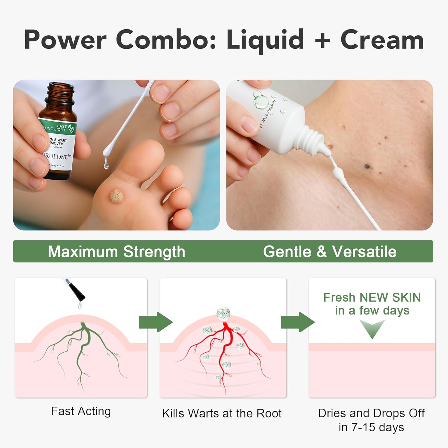 2-in-1 Dual Action Wart Remover Kit – Liquid & Cream Formula with Salicylic Acid, Fast-Acting for Plantar & Common Warts on Hands, Feet, Body & Sensitive Areas - Image 6