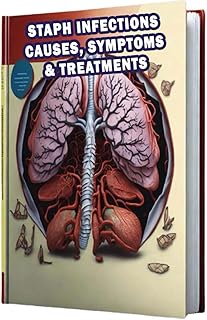 Staph Infections Causes, Symptoms & Treatments: Learn about the causes, symptoms, and available treatments for staph infections.