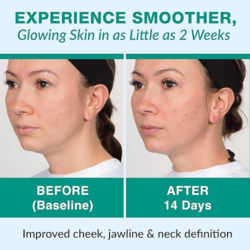 Miniatura 5 de Ventosas de masaje facial y anticelulítico para uso profesional y en casa set de ventosaterapia con libro sobre el tema PDF de Lure