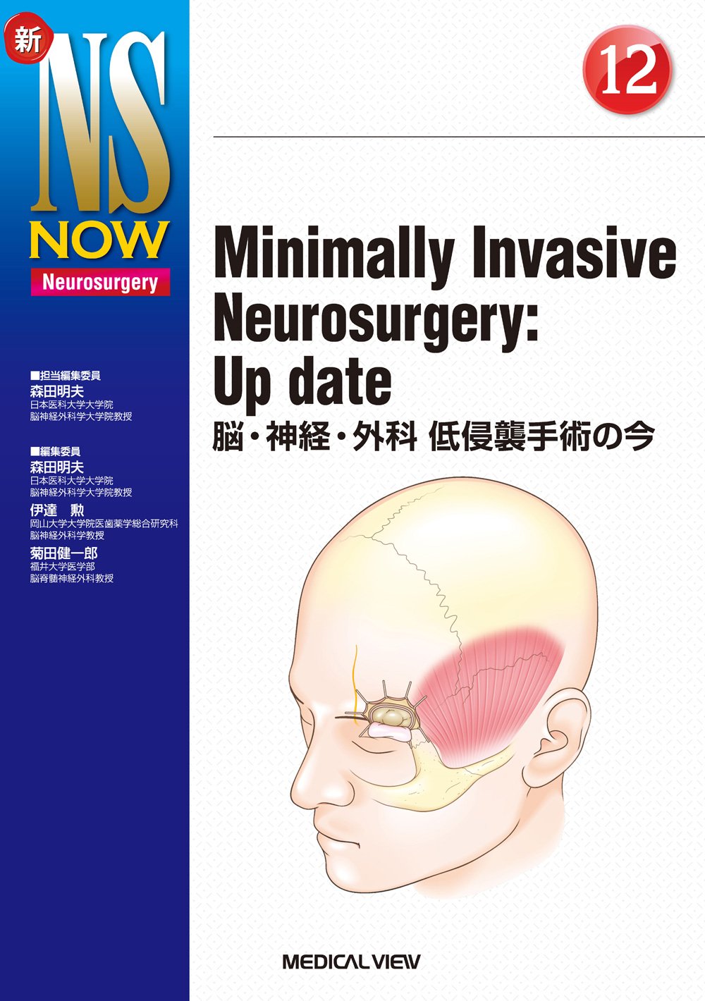 新 NS NOW Neurosurgical ReOperations Amazon.com: Minimally