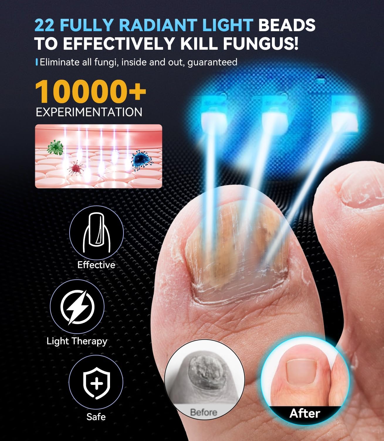 2025 6.0 Upgrade Nagelpil Lasergerä【mit Zeitanzeige - 30s/60s/99s】Faltbares Gerät Nagelpilz Lasergerä 905nm Infrarotlicht/470nm Blaulicht und geeignet für den Heimgebrauch(Schwarz)