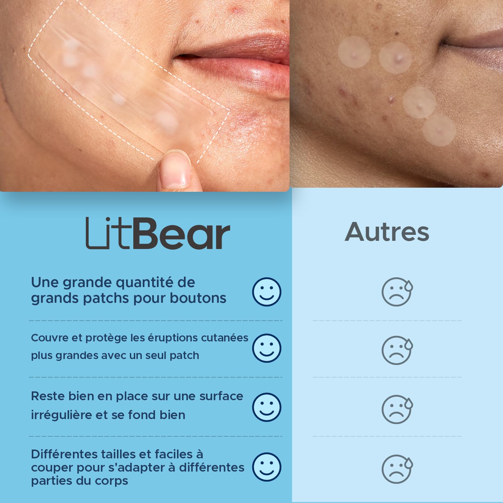 LitBear Patchs Hydrocolloïdes pour Boutons (5 Tailles 156 Patchs) - Visage, Menton, Dos, Corps