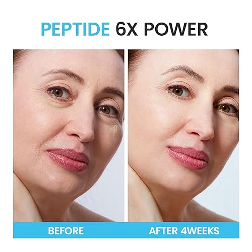 Miniatura 4 de Crema para el cuello Go Pure Tighten and Lift Crema reafirmante y reafirmante de la piel - Crema reafirmante para piel suelta, crema para el cuello