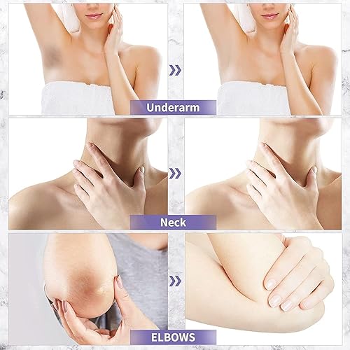 Miniatura 3 de Acclyd - Crema corrector de manchas oscuras para el cuerpo, áreas íntimas, axilas, axilas, rodillas, piernas, codos y muslos internos, crema