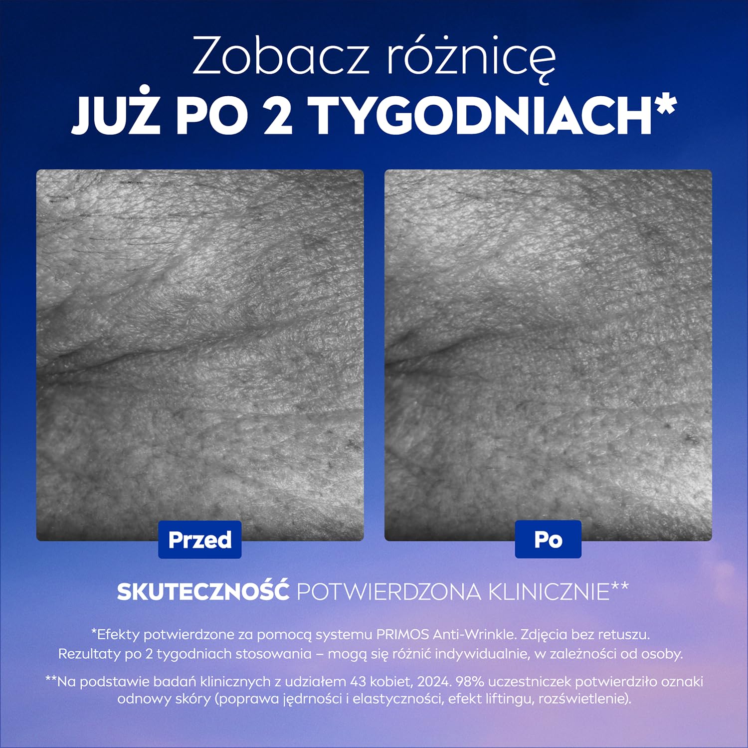 NIVEA CELLULAR Epigenetics Przeciwzmarszczkowe serum odmładzające do twarzy na dzień z kwasem hialuronowym, 30 ml